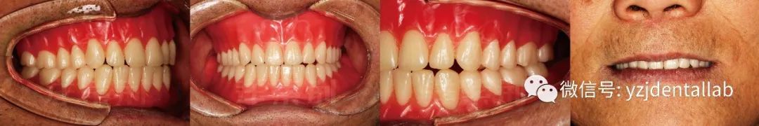 病例教学视频,病例分析操作技能