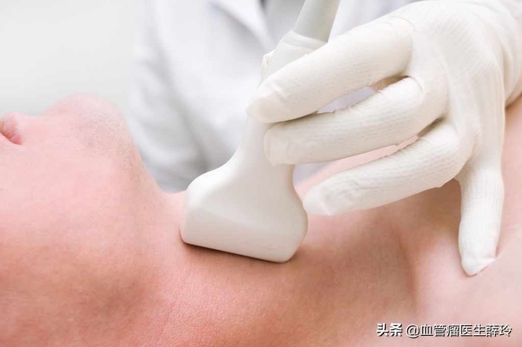 海绵状血管瘤的治疗和日常注意事项!