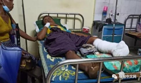 疫情当下风雨飘摇,缅甸最新疫情局势图表