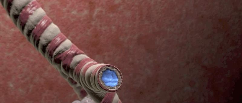 哮喘过敏症的症状,呼吸道过敏哮喘症状