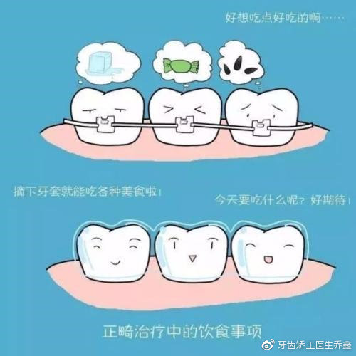 矫正牙齿戴牙套好还是隐形牙套好,牙齿矫正用隐形牙套还是传统牙套