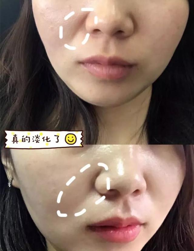 李佳琦推荐保湿面霜平价,李佳琦推荐的十样必买面霜