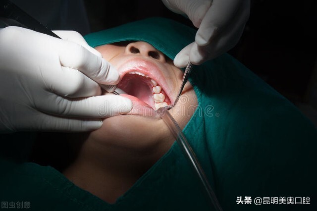 牙齿一般拔了多久能种牙,牙齿拔掉后多久种植牙比较好呢