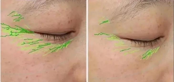 眼部保养重在“润”，用它一喷好舒服！细纹都慢慢膨了起来