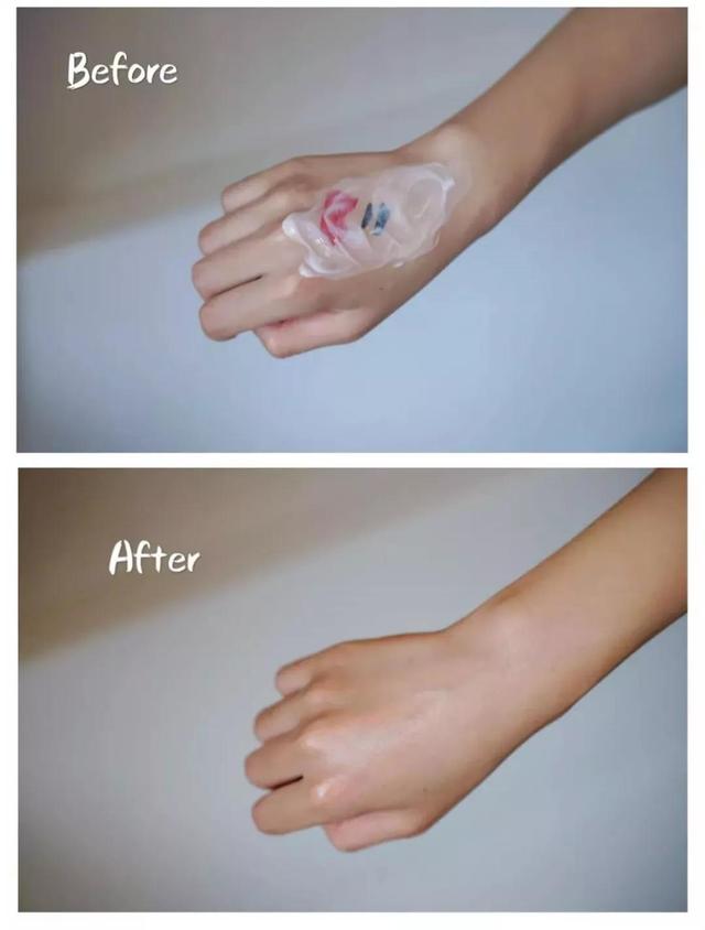 毛孔粗大黑头多怎么改善小技巧,毛孔粗大黑头多的原因和改善方法