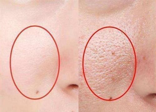 卸妆不彻底肤色不均,卸妆不彻底的后果