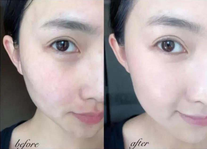 那些学化妆的女孩子后来怎么样了,学医美的女生怎么样