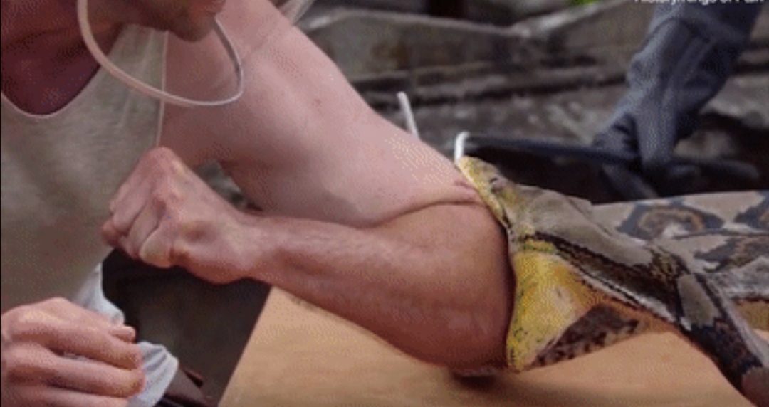 被毒蛇咬伤有多痛苦,被毒蛇咬伤后有哪些临床表现呢