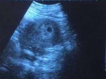 意外怀孕的宝宝是幸运的,意外怀孕不知道是喜还是忧