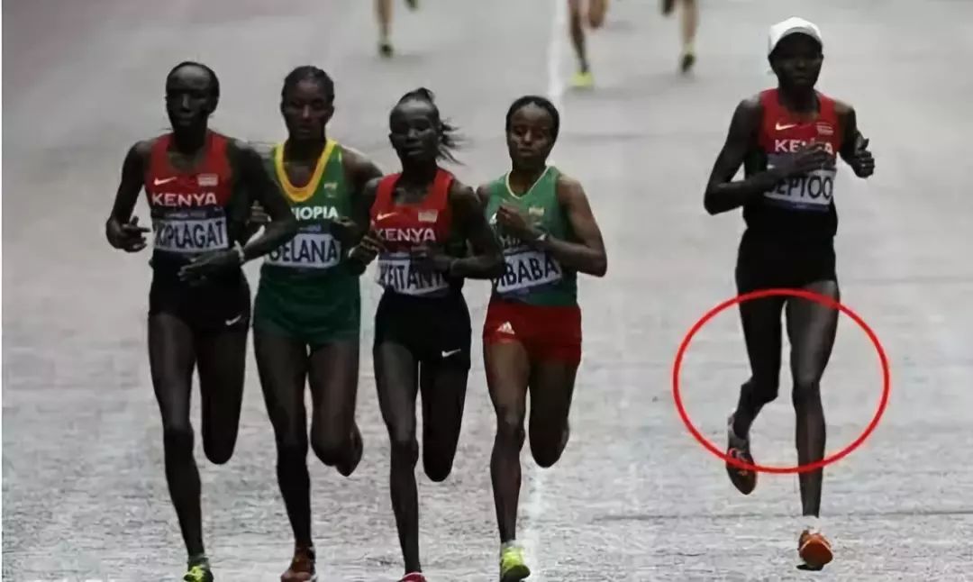 x型腿怎样矫正,青少年x型腿矫正最佳时间