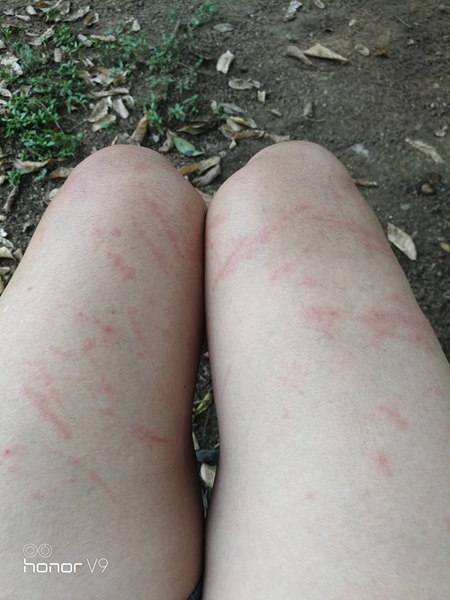 一双被水草割伤的老腿