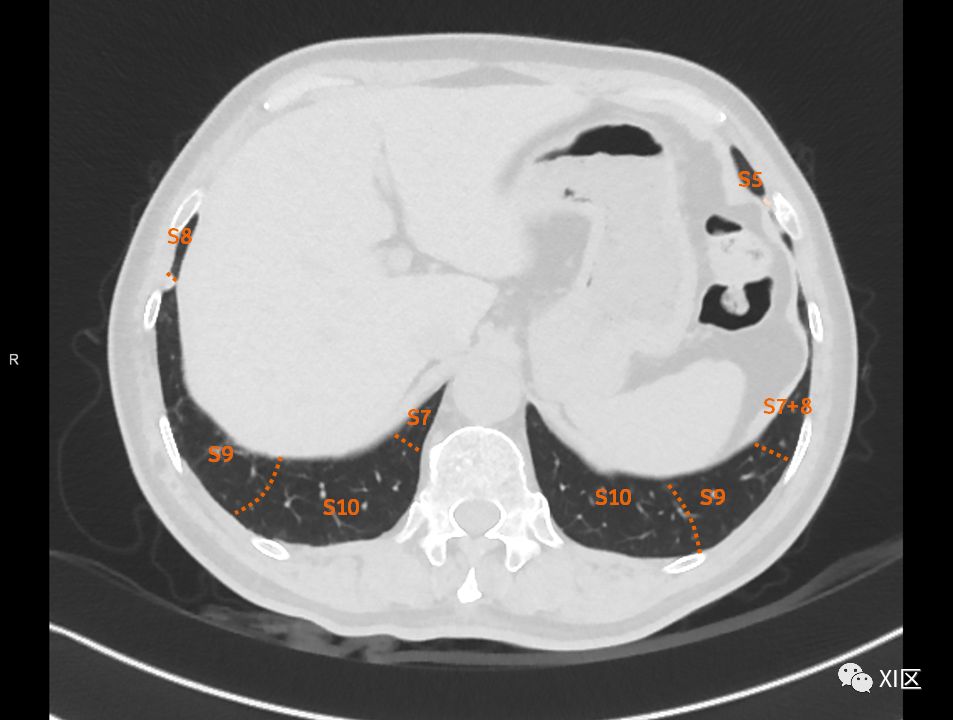 如此详细的肺部影像解剖，有点儿酷！