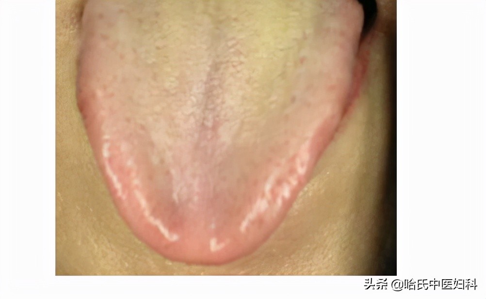 备孕期间如何让卵泡长得更快,卵泡长不大怎么办如何促排卵