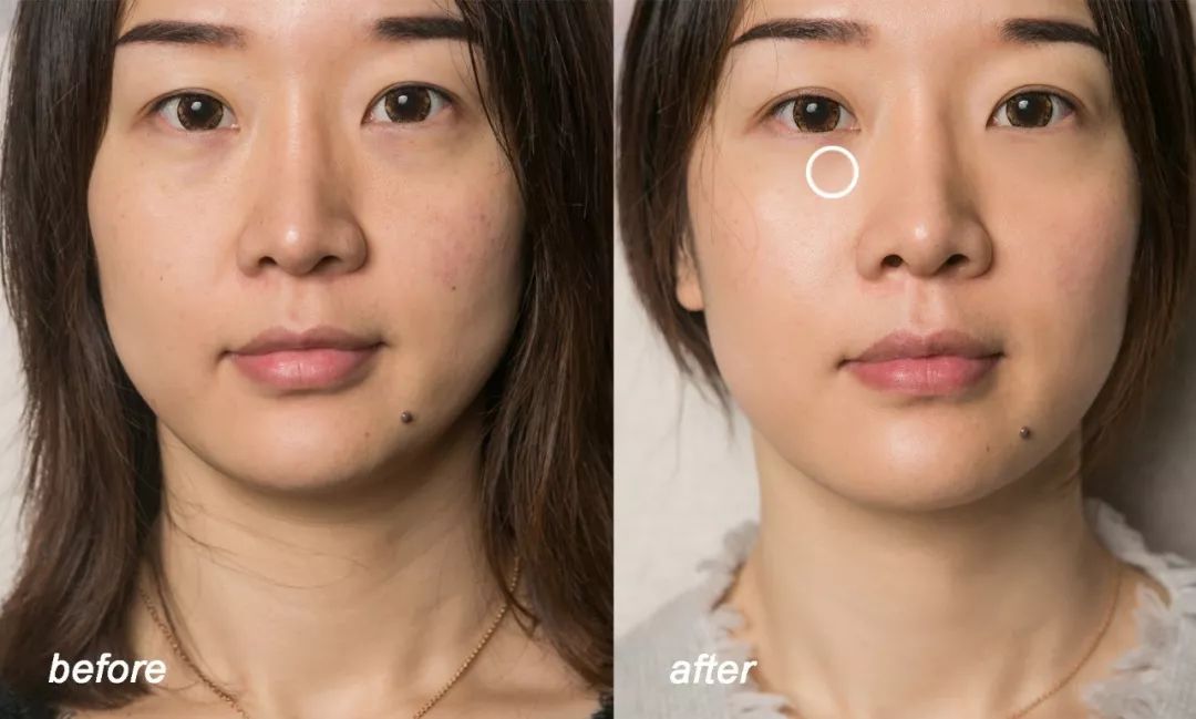 小茂肌诊室∣美容仪挑战：家用美容仪到底值得投资吗？