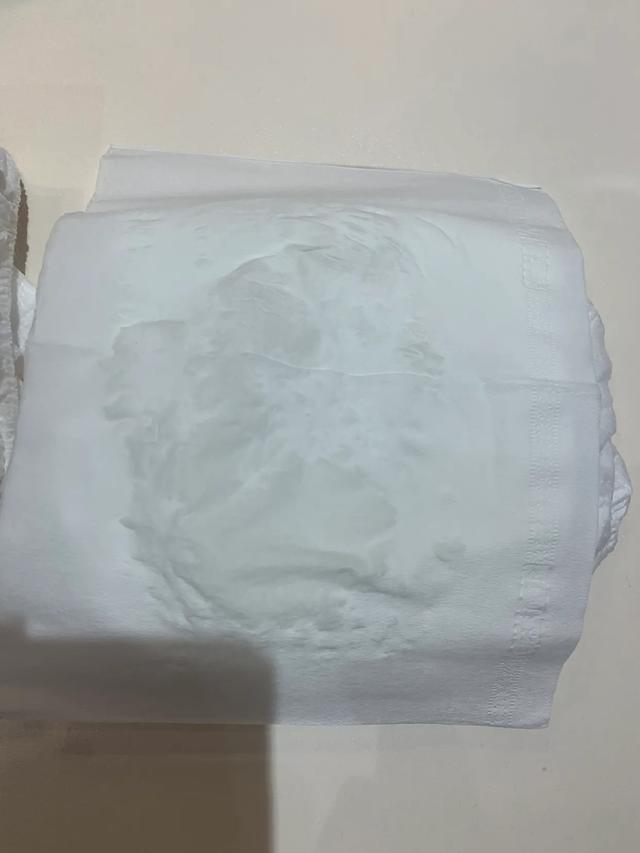 什么纸尿裤不过敏,纸尿裤为什么会过敏