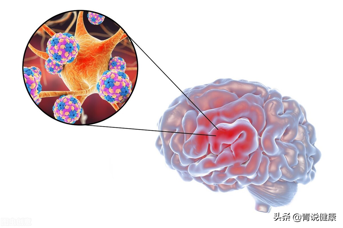 治疗头晕的锻炼方法,彻底治疗头晕的好药