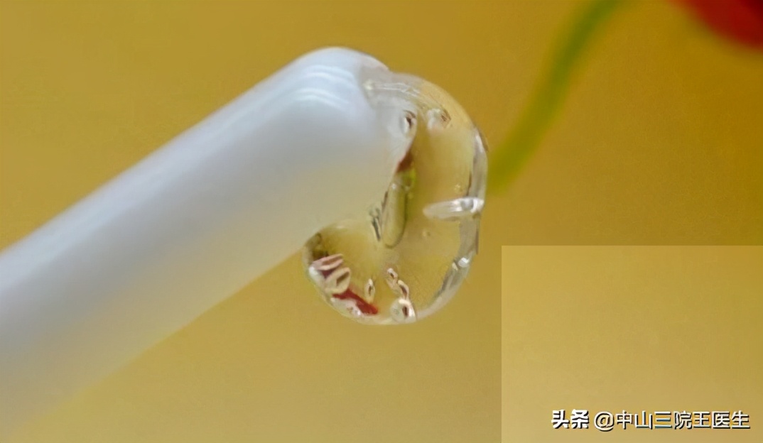 宫颈出现问题腿部表现,女性宫颈病变怎么引起的