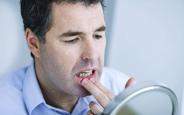 牙齿稀疏牙缝大真的影响财运吗,牙缝越来越宽有什么好办法