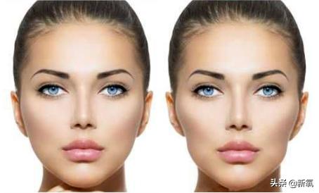 戴牙套真的会出现牙套脸,戴牙套期间牙齿变龅了