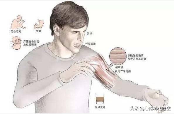 立普妥副作用和用药禁忌,立普妥的副作用都有哪些