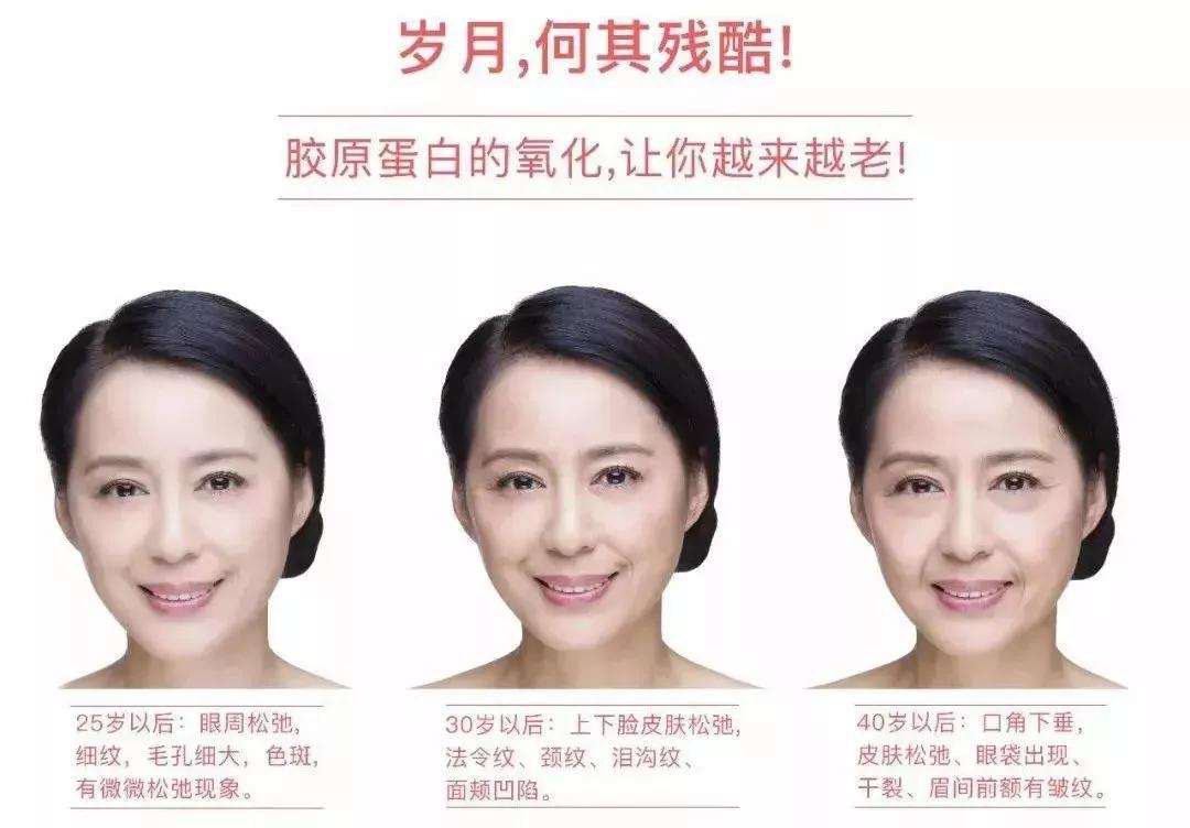 改善皱纹松弛抗皱乳液,抗皱松弛淡化皱纹鱼尾纹