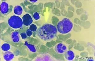 什么是汉坦病毒？人传人吗？可以治愈吗？如何预防呢？死亡率呢？