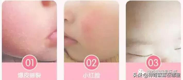 十大公认好用宝宝面霜,公认最好用的宝宝面霜排名前十