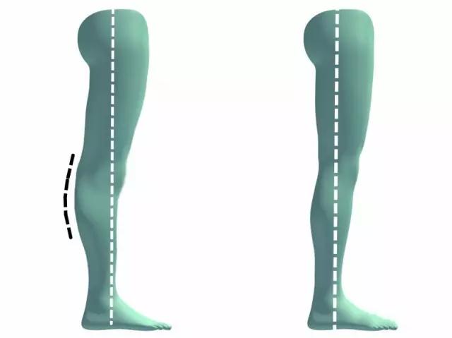 弯腿最快的方法,怎么更有效的弯腿练习