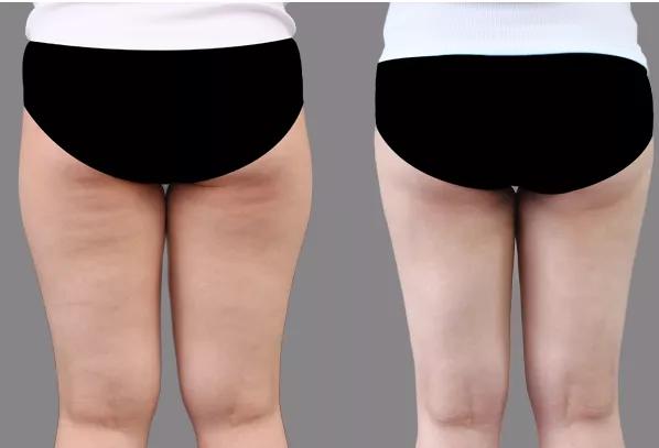 日搓谷道一百遍,消除疾病又延年