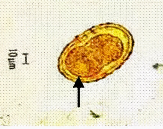 检查身体有没有虫怎么检查,身上有小黑点点一样的虫子