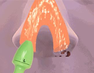 洗鼻器哪款最好,家用电动洗鼻器品牌推荐