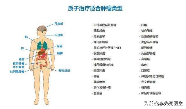 质子重离子能治癌转移吗,治癌利器质子重离子