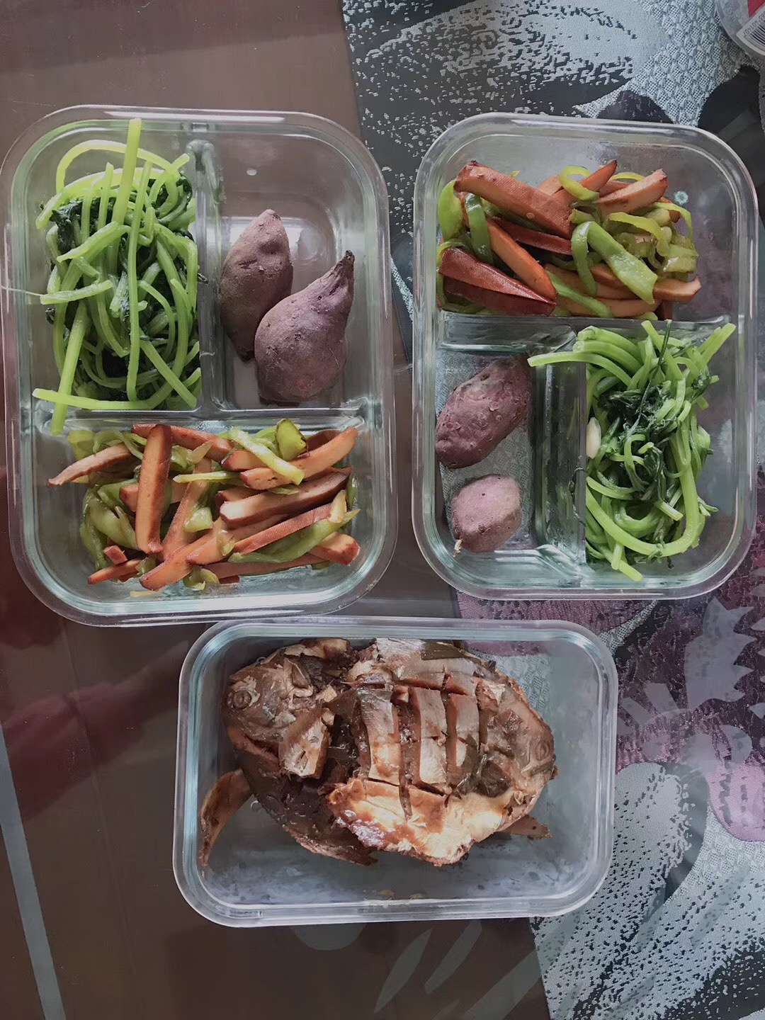 胆结石怎样才能把石头排出来,胆结石怎么消除