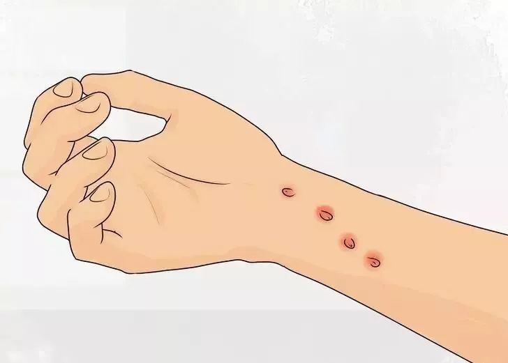 被猫舔证明什么,被猫咪舔过伤口真的会死吗