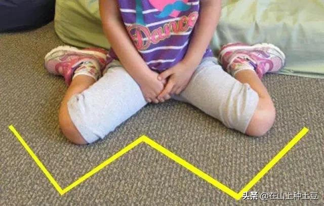 W坐真的会让孩子o型腿吗？正确的坐姿长啥样？