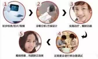 牙齿矫正反弹最快的补救法,牙齿矫正轻微反弹应该怎么办