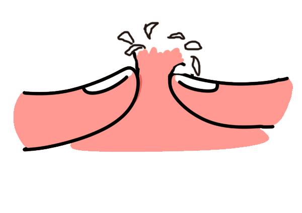 教你如何快速祛痘，成为无痘小仙女