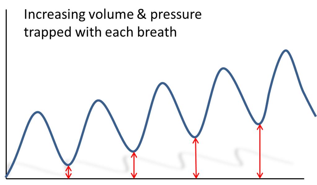新冠肺炎机械通气系列课程(讲义)-阻塞性肺病的机械通气