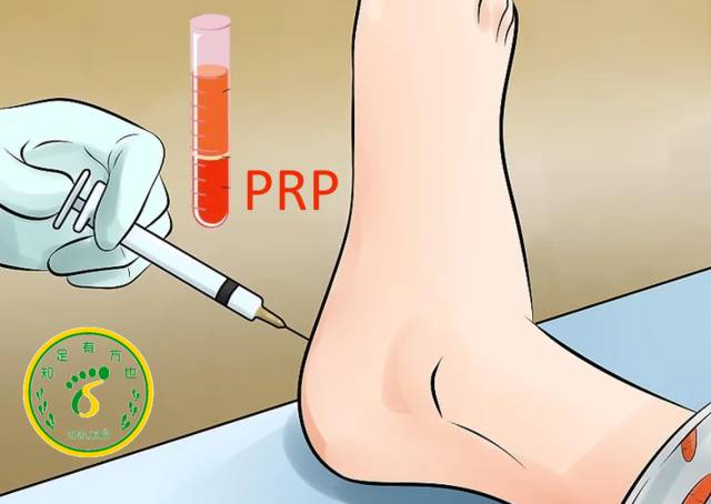 足跟跖筋膜炎是什么原因引起的,足跟跖筋膜炎刺血疗法