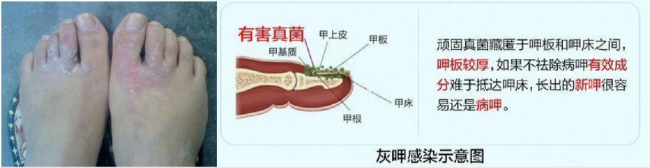 引起女性私密疾病原因有哪些？