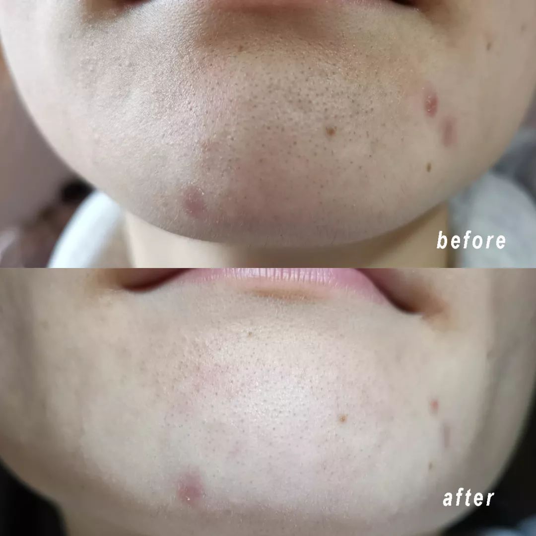 清洁面膜测评真实,清洁面膜测评打假