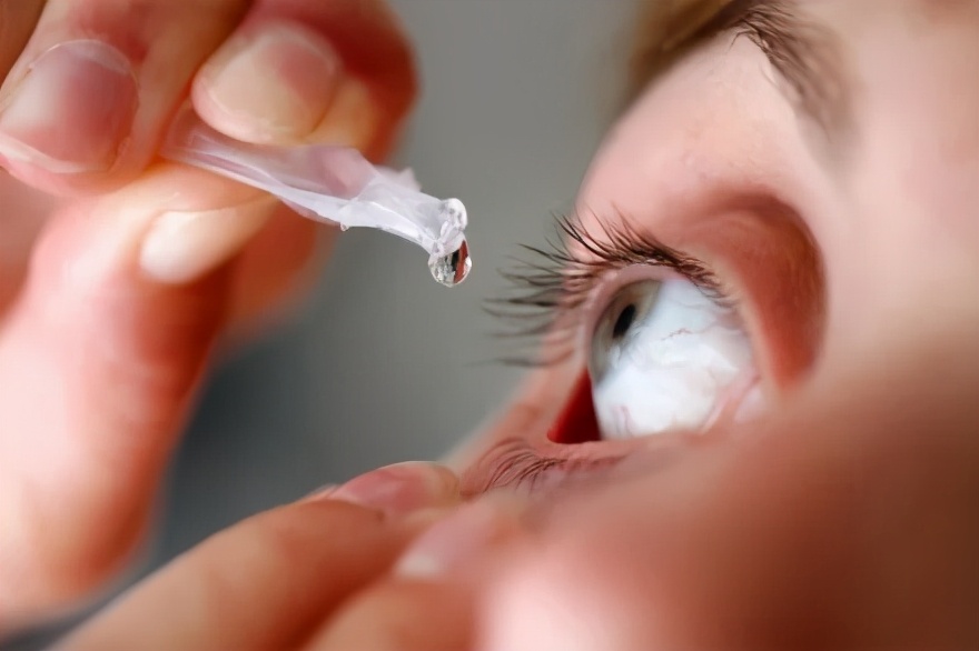 眼药水没打开过期两月能用吗,眼药水开封后只能用1个月