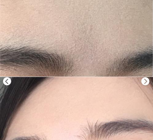 皮肤不吸收水是什么原因,皮肤搓泥不吸收护肤品怎么办