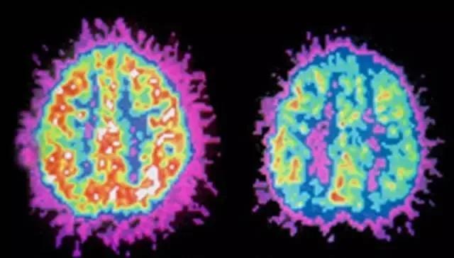 屡教不改的孩子什么心理,多动孩子屡教不改是故意的吗