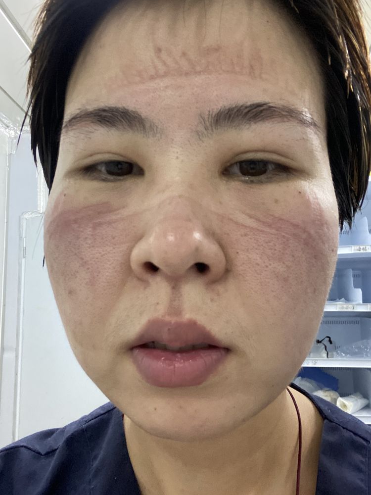 雷神山上,听三朵花开的声音——沈阳市红十字会医院医生关晓宣、护士于娜、陈佳驰援武汉雷神山日记