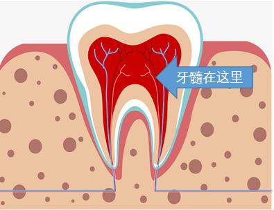辟谣快速缓解牙疼,辟谣消炎药是抗生素