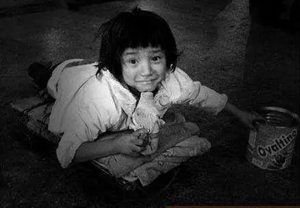 眼球被挖走了还能恢复吗,眼球被挖了还会活着吗