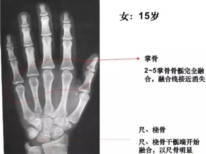 孩子个子高却跑不快,小孩个头不高
