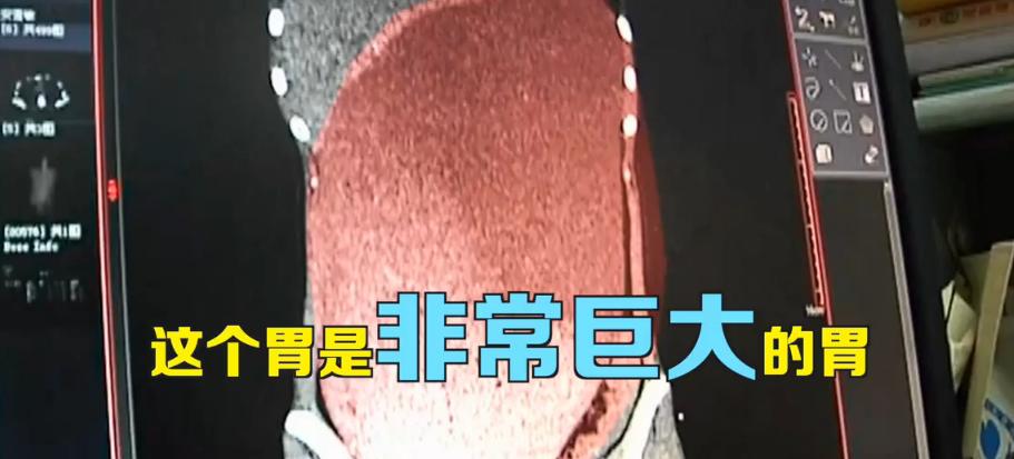 暴食就是没有自控力,暴食不是真正的快乐