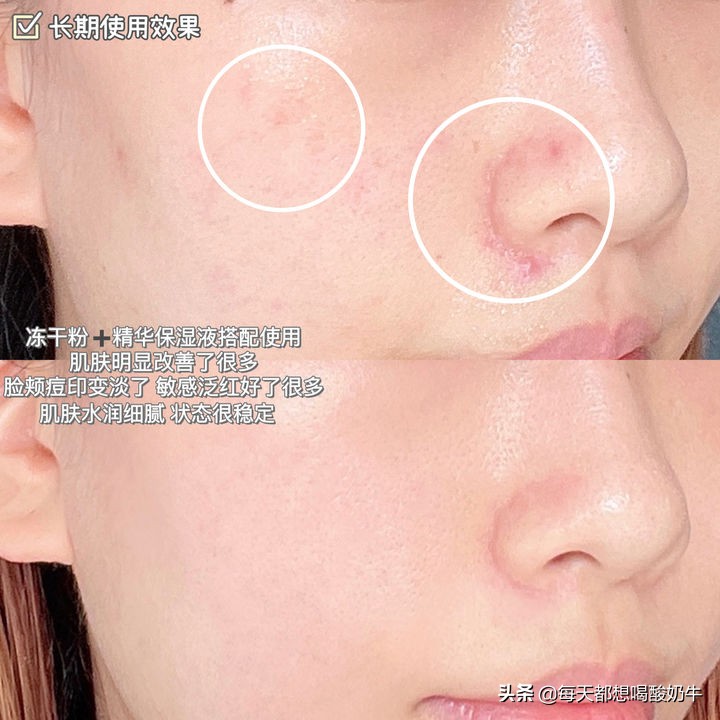 适合夏天的爽肤水推荐,适合夏季平价好用的爽肤水